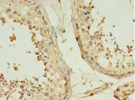 TMEM141 Antibody (aa1-108)
