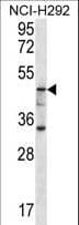 GBA3 / CBG Antibody (aa296-325)
