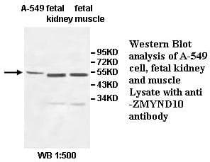 ZMYND10 Antibody (aa161-421)
