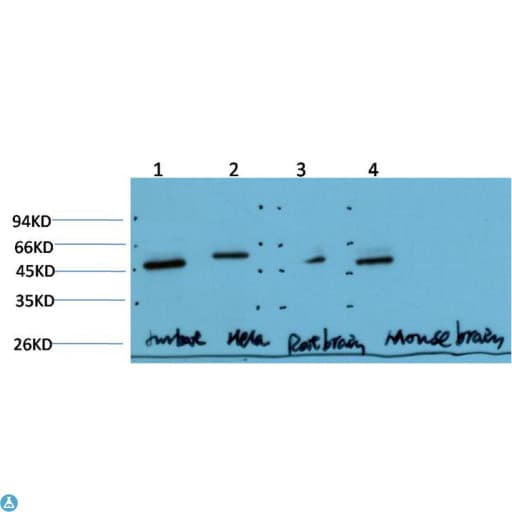 TUBG1 / Tubulin Gamma 1 Antibody