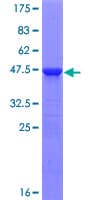Human IFT22 / RABL5 Protein (Recombinant GST)
