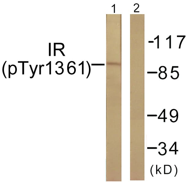 INSR / Insulin Receptor Antibody (phospho-Tyr1361)