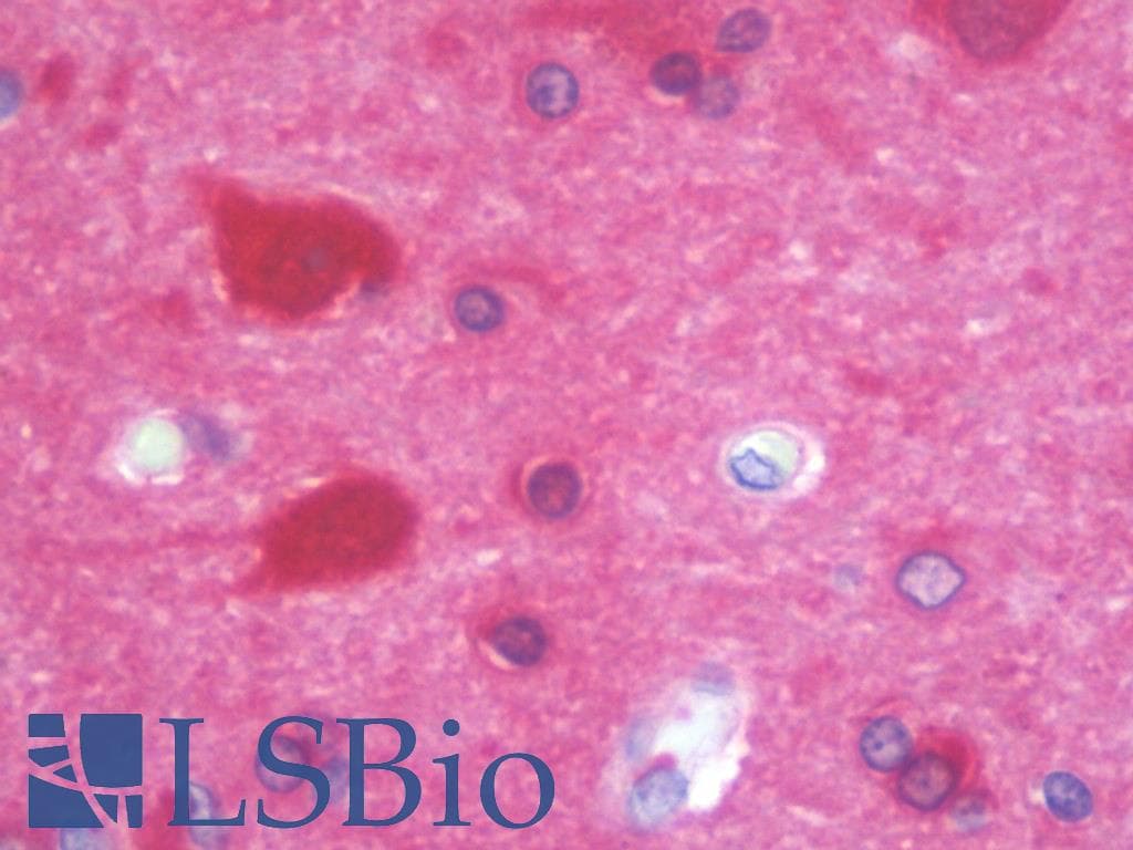IHC-plus™ MAPRE2 / EB2 Antibody (clone 1F3)
