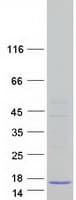 Human ARL9 Protein (Recombinant Myc-DDK (Flag))