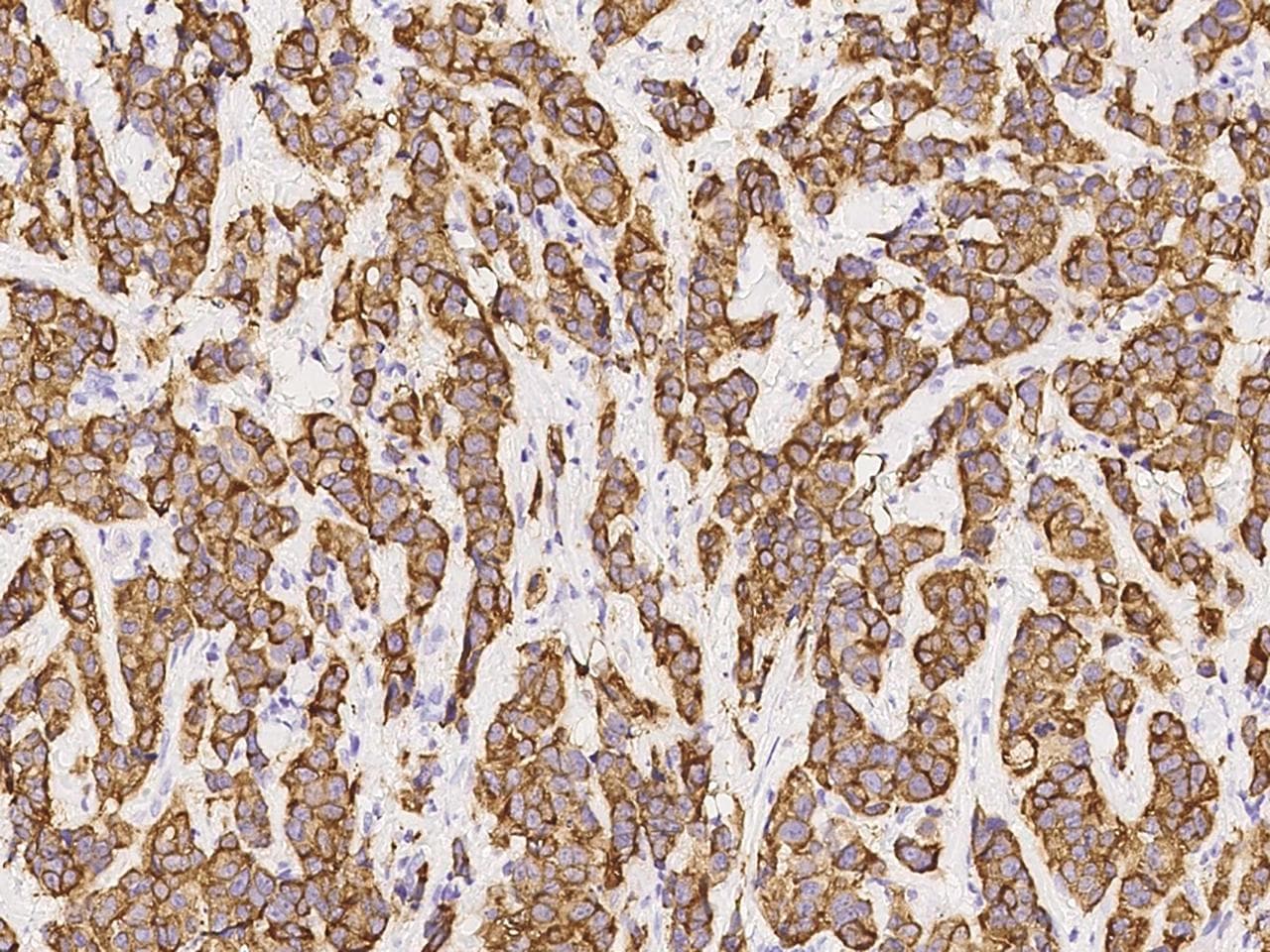 Polyclonal Rabbit anti-Human COL9A1 / Collagen IX Antibody (Preservative Free, IHC)