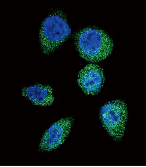 MTOR Antibody (Ser2481)