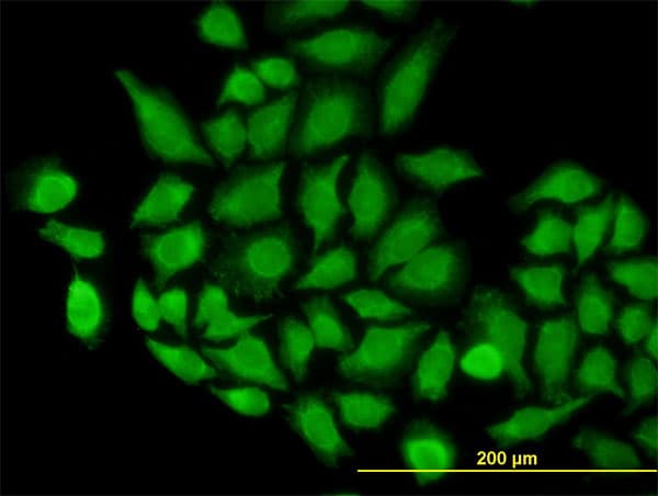 IHC-plus™ TOMM22 / TOM22 Antibody (clone 4G4)
