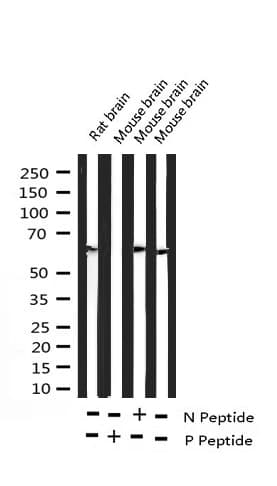 DOK1 Antibody (phospho-Tyr398)