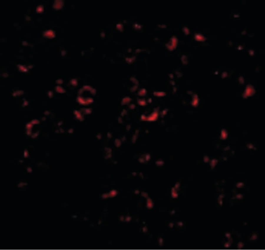 MCL1 / MCL 1 Antibody