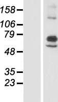 ARSI / Arylsulfatase I Protein (Over-Expression Lysate Myc-DDK (Flag))