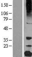 CRYGC / CCL Protein (Over-Expression Lysate Myc-DDK (Flag))