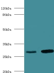 CA1 / Carbonic Anhydrase I Antibody
