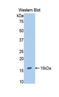CD105 Antibody (aa26-136, Biotin)