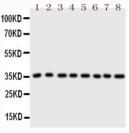 ANXA3 / Annexin A3 Antibody (aa124-141)