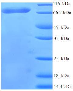 Human Harmonin / USH1C Protein (Recombinant His-SUMO)