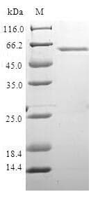 Human XRCC4 Protein (Recombinant GST, N-terminus)