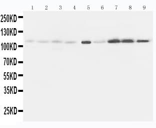 Polyclonal Rabbit anti-Human EPHA1 / EPH Receptor A1 Antibody (aa963-976, IHC, WB)