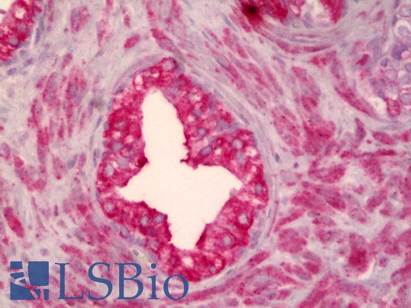 IHC-plus™ SMO / Smoothened Antibody (clone 3D10)