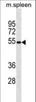 VISA / MAVS Antibody (aa1-30)