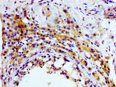 Recombinant Monoclonal Rabbit anti-Human CD81 Antibody (IHC, WB)