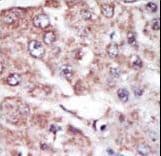MARK2 Antibody (aa600-630)