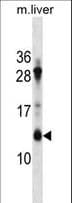 ATP5G1 / ATP5G Antibody (aa27-56)