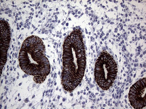 KRT16 / CK16 / Cytokeratin 16 Antibody (clone OTI2F3)
