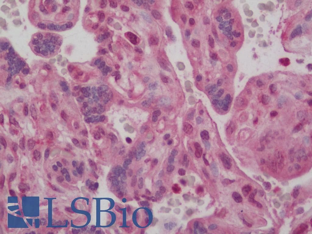 IHC-plus™ Polyclonal Rabbit anti-Human EFTU / TUFM Antibody (IHC, WB)