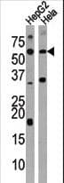 ACVR1C / ALK7 Antibody (aa33-62)