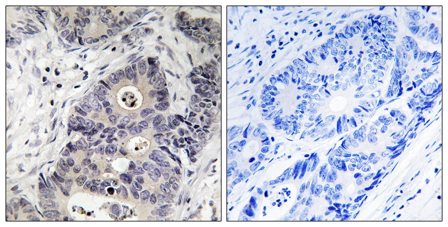 Polyclonal Rabbit anti-Human NOS2 / iNOS Antibody (phospho-Tyr151, IHC)