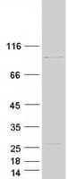 Human PPP1R21 / KLRAQ1 Protein (Recombinant Myc-DDK (Flag))
