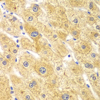 RICK / RIP2 Antibody