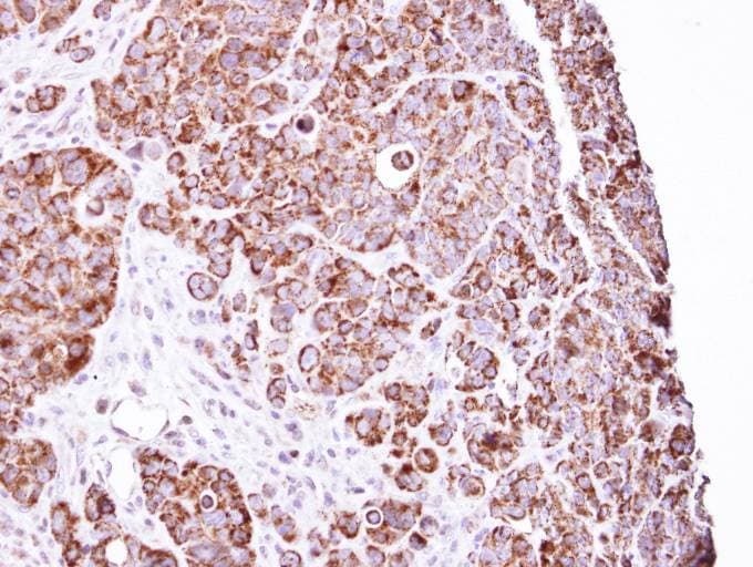 Polyclonal Rabbit anti-Human LRPPRC Antibody (aa611-937, IHC, WB)
