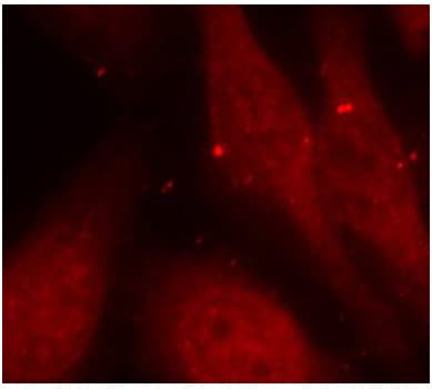 Polyclonal Rabbit anti-Human ABL1 / c-ABL Antibody (phospho-Tyr412, IHC, IF)