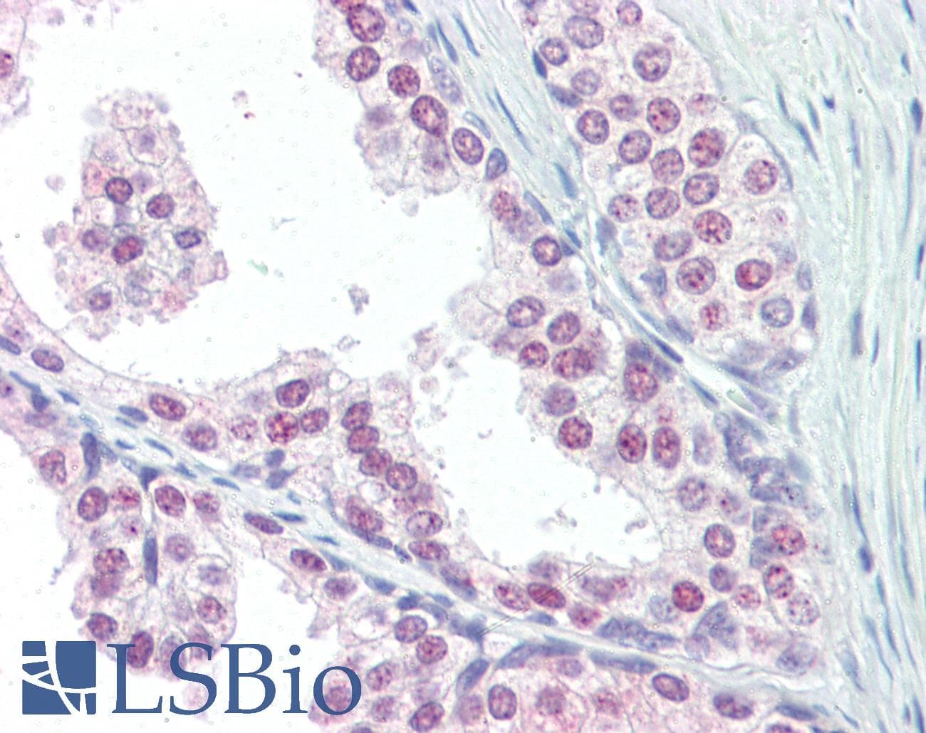 IHC-plus™ UBC / Ubiquitin C Antibody (aa36-66)