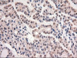 Monoclonal Mouse anti-Human MYC / c-Myc Antibody (clone OTI1A6, IHC, IF, WB)