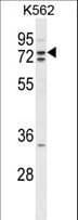 ZRANB1 / TRABID Antibody (aa665-692)