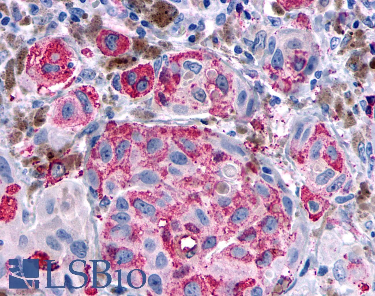 PathPlus™ Polyclonal Rabbit anti-Human OPRD1 / Delta Opioid Receptor Antibody (N-Terminus, IHC)