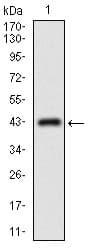 Monoclonal Mouse anti-Human ABCC4 / MRP4 Antibody (clone 2D2A9, aa631-692, IHC, WB)