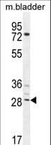 AKIP1 / BCA3 Antibody (aa54-83)