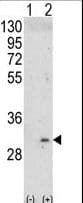 Polyclonal Rabbit anti-Human ITM2A Antibody (aa22-49, WB)