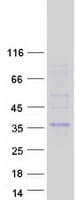 Human CTDSPL Protein (Recombinant Myc-DDK (Flag))