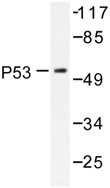 TP53 / p53 Antibody (Lys386)