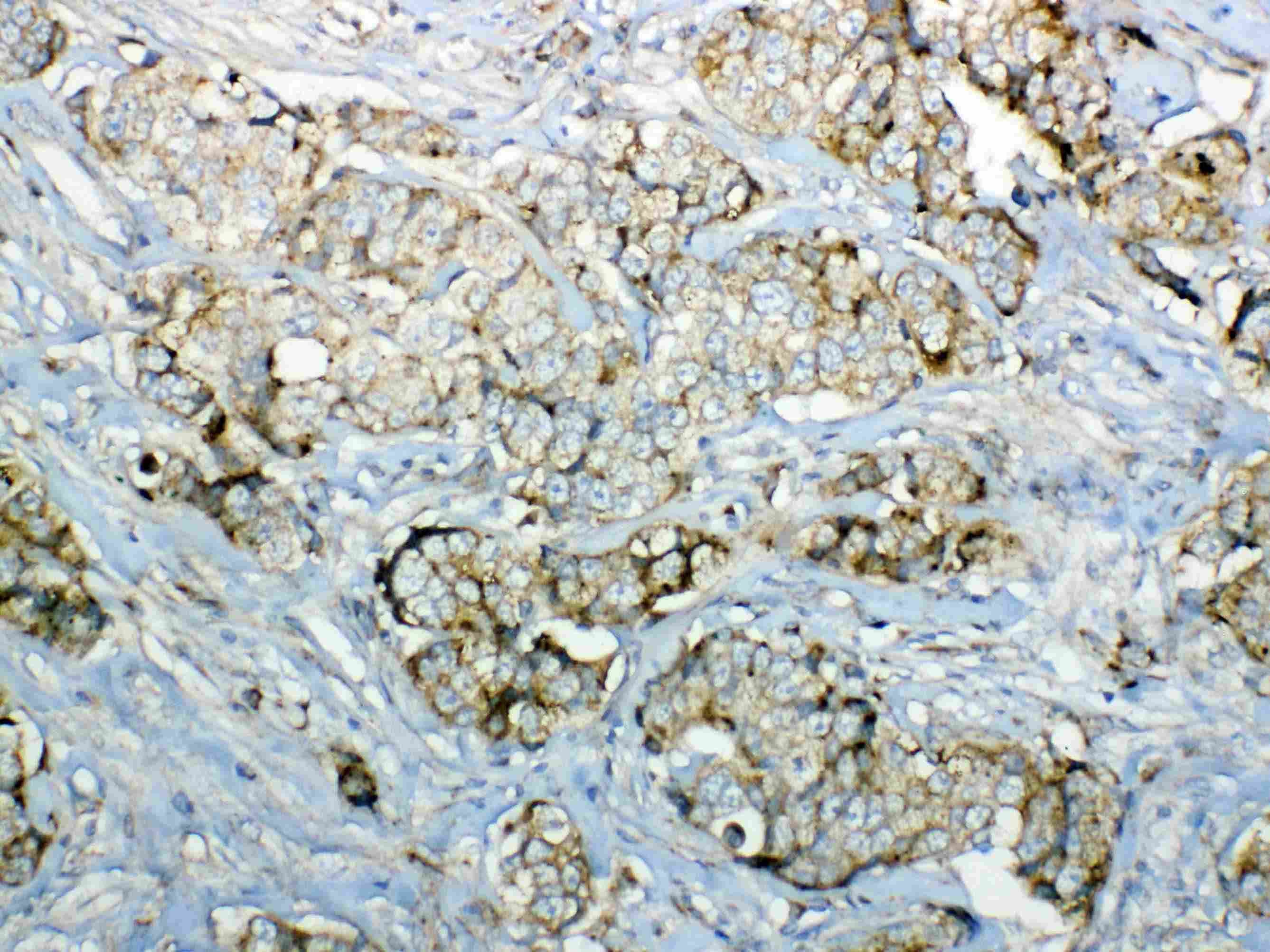 GALNS / Chondroitinase Antibody