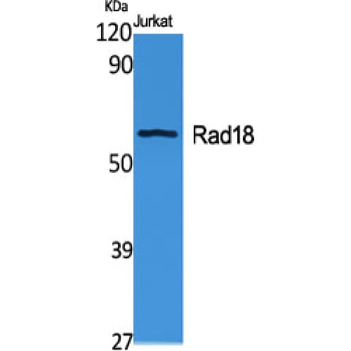 RAD18 Antibody (270-350 aa, Internal)