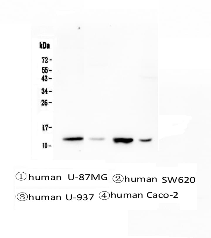 CSTB / Cystatin B / Stefin B Antibody
