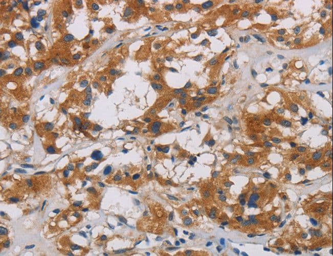 CNDP1 Antibody