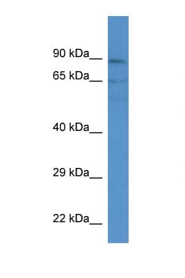 Polyclonal Rabbit anti-Human ACSM3 / SAH Antibody (aa45-94, WB)