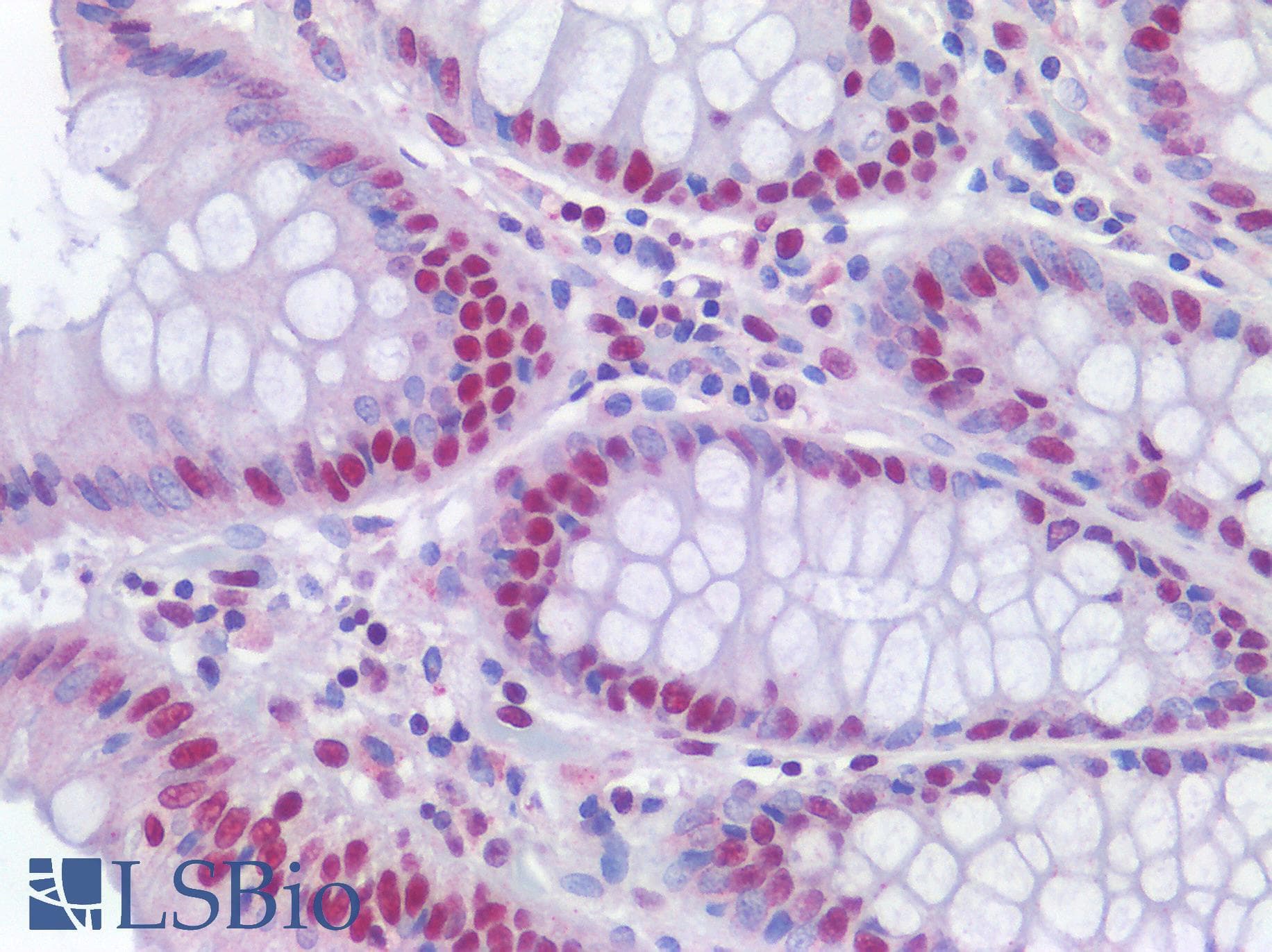 IHC-plus™ POLR2A / RNA polymerase II Antibody (1560-1640 aa)