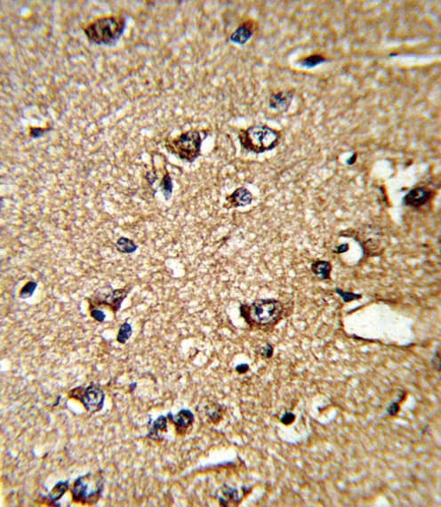 PPIA / Cyclophilin A Antibody (aa8-37)